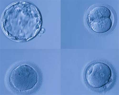 山西省试管婴儿供卵 2023山西做供卵试管婴儿包生男孩多少钱？ ‘孕囊数据两小